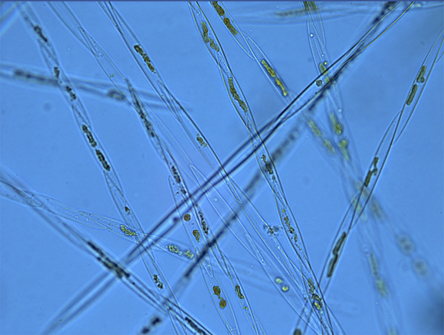 #MicroMonday: Festive, Yet Toxic